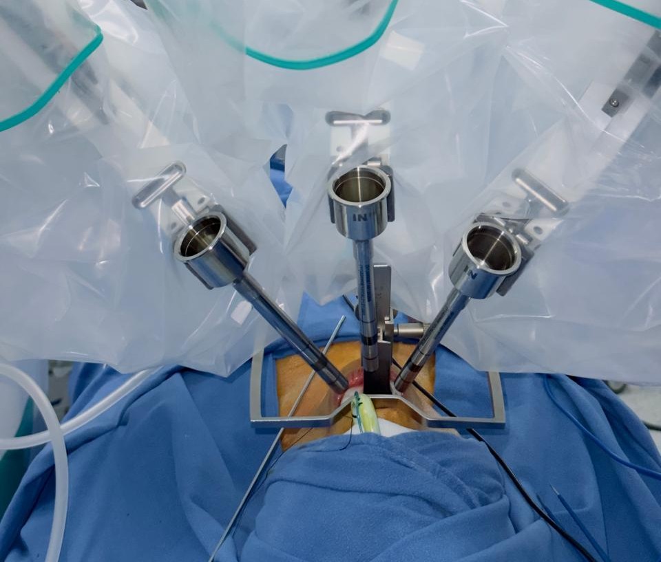Robotic Surgery for Head and Neck Cancer: How the Technology Actually Works