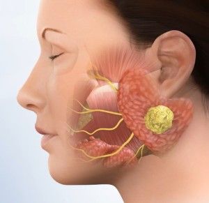 Salivary Gland Surgery in Delhi NCR